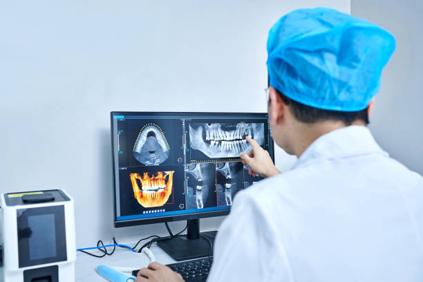 Best Knocked-Out Tooth (Avulsed Tooth) Treatment in Au Sable, MI